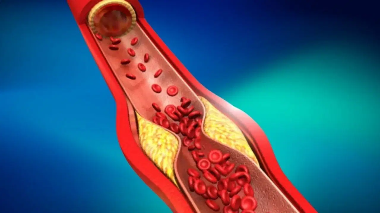 Tutkijat ovat oppineet hallitsemaan kolesterolin aktiivisuutta valon avulla